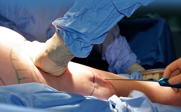 july 2013 Hard Core Weight Loss